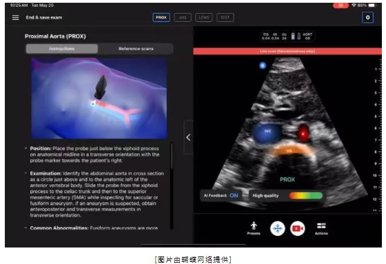 【海外風雲】Butterfly Network 推進人工智能在主動脈瓣篩查中的應用-江蘇網站制作